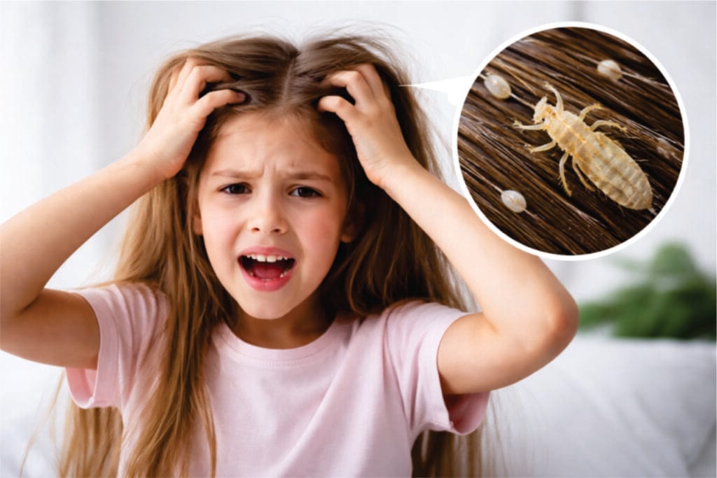 How to Remove Head Lice Naturally at Home 1 child scratching head due to head lice infestation